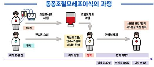 조혈모 줄기세포 이식 과정 그림